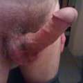 SCOOT69
